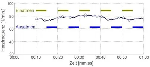 Stressindex