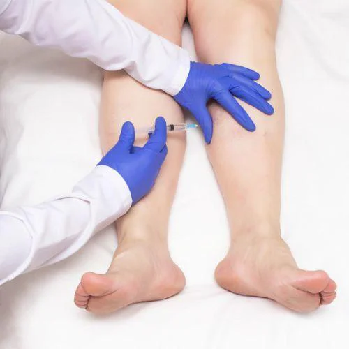 Behandlung der Venen