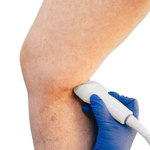 Untersuchung der Venen