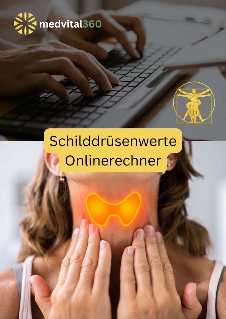 SD Online Rechner